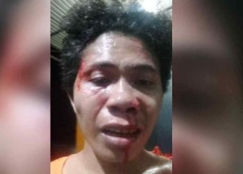 Berteduh di Taman Perdos, Mahasiswa UHO Diserang OTK