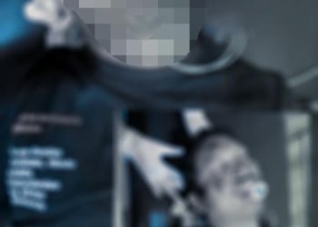 Usai Konsumsi Miras, Pengendara Sepeda Motor Tabrak Pagar Pembatas di Kendari
