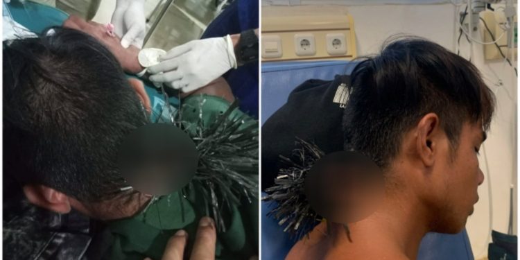 Ketgam: Korban yang terkena busur oleh OTK di Kendari Beach. Foto: Istimewa