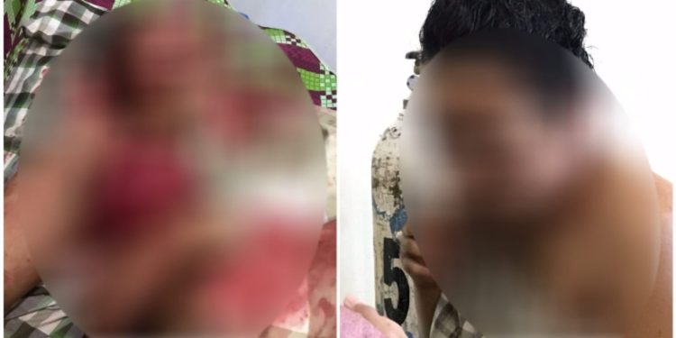 Ketgam: Korban KDRT di Konawe Utara. Foto: Istimewa