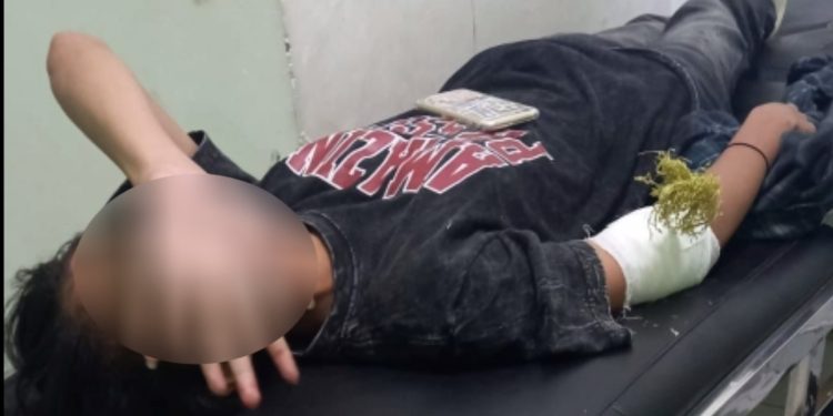 Ketgam: Seorang gadis bernama Salsa menjadi korban pembusuran OTK. Foto: Istimewa