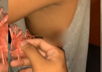 OTK Terus Beraksi, 1 Anak Busur Menancap di Dada Seorang Tukang Ojek di Kendari
