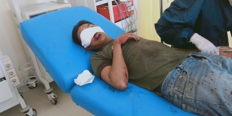 Ketgam : Kondisi salah satu korban pembacokan. Foto : Istimewa