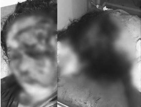 Ketgam: Kondisi korban perampokan dengan kekerasan di Kolaka Utara. Foto: Istimewa