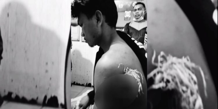 Ketgam : Korban pengeroyokan dan pembusuran di Pelabuhan Perikanan Samudera
Foto : Istimewa