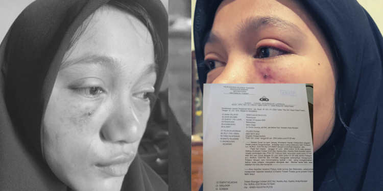 Mahasiswa Korban penganiayaan 2 seniornya di UHO