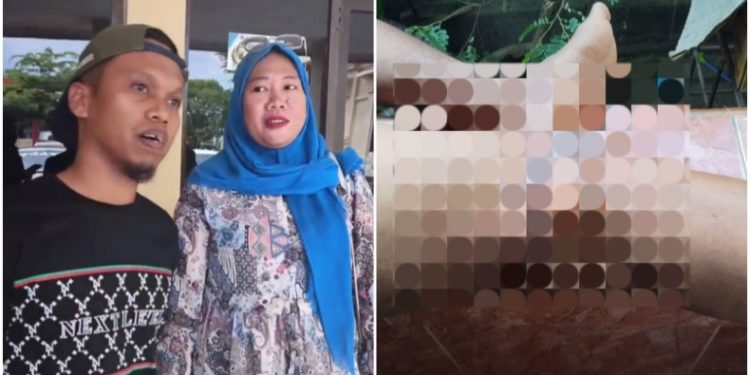 Pasutri Ardi dan Dian mendatangi Polresta Kendari untuk melaporkan penyiraman air panas yang dilakukan istri oknum polisi, Selasa (26/5/2026). (Foto: Istimewa)